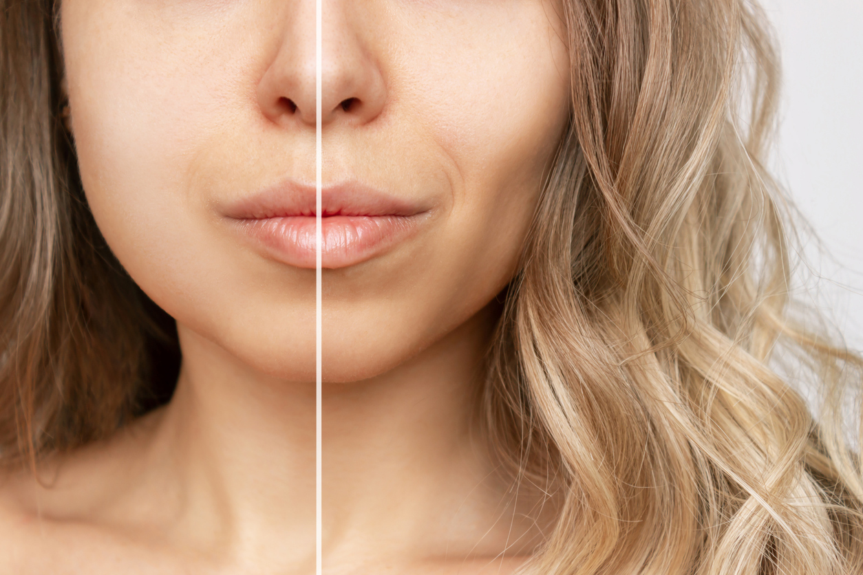 Discover the Secrets to Eliminating Your Double Chin for a More Defined Jawline what is mewing